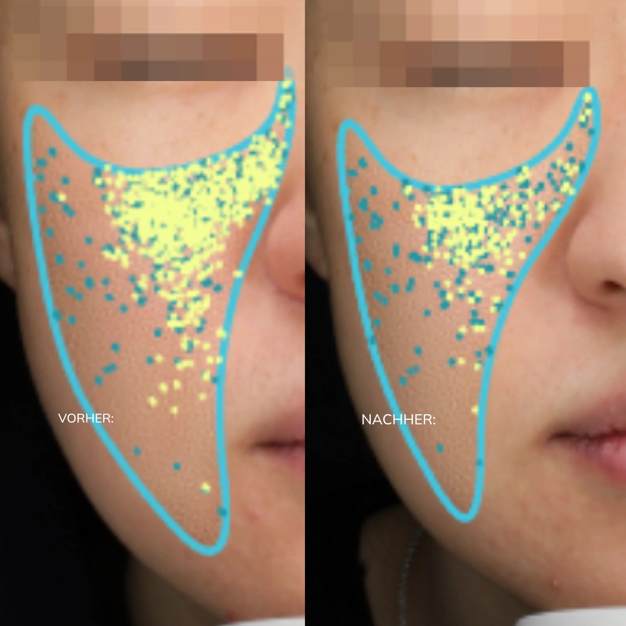 Collagen_Activator_PDP_BeforeAfter_LANG_DE.webp